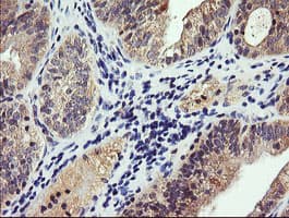 PIK3CG / PI3K Gamma Antibody (clone OTI4G10)