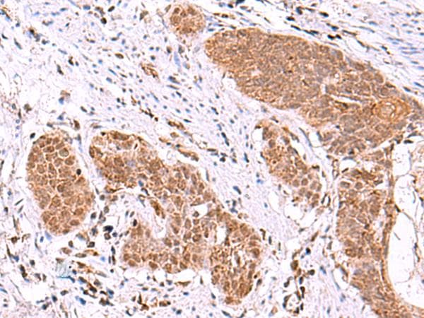 Polyclonal Rabbit anti-Human ASTN2 Antibody (aa1120-1339, IHC)