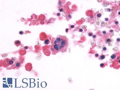 PathPlus™ Polyclonal Rabbit anti-Human ADGRE5 / CD97 Antibody (Cytoplasmic Domain, IHC)