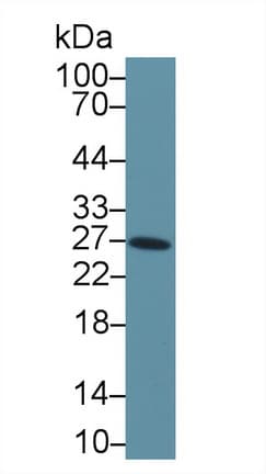 TIMP4 Antibody (aa32-224, Biotin)