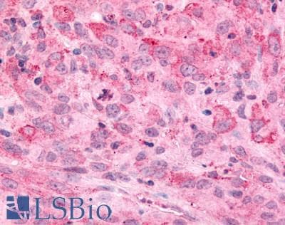 PathPlus™ Polyclonal Rabbit anti-Human MINK1 / MINK Antibody (Internal, IHC)