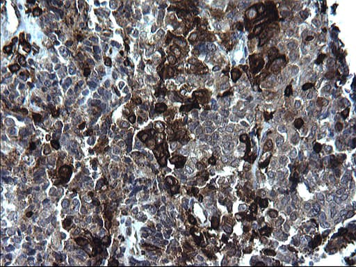 CD74 / CLIP Antibody (clone OTI1H3)
