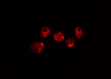 Polyclonal Rabbit anti-Human CHEK2 / CHK2 Antibody (IHC, IF, WB)