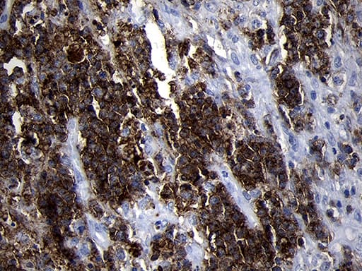 CD79B / CD79 Beta Antibody (clone OTI8A12)