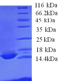 Human APOC4 / Apolipoprotein CIV (Recombinant His)