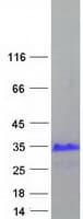 Human XAGE3 Protein (Recombinant Myc-DDK (Flag))