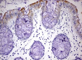 KRT24 / Keratin 24 Antibody (aa139-397, clone OTI2A2, Carrier-free)