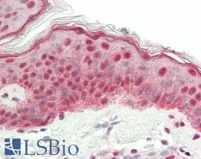 IHC-plus™ NCOA2 / TIF2 Antibody (aa1400-C-term)