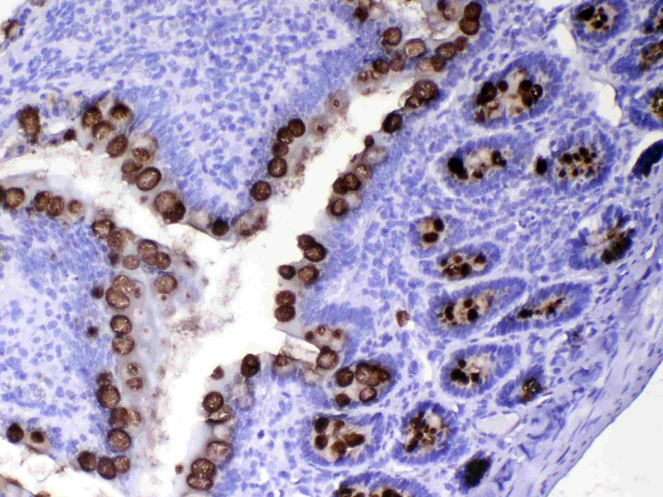 TFF3 / Trefoil Factor 3 Antibody
