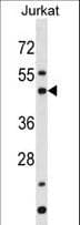 Polyclonal Rabbit anti-Human BAG5 Antibody (aa21-50, WB)