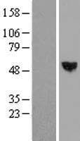 SCPEP1 / RISC Protein (Over-Expression Lysate Myc-DDK (Flag))
