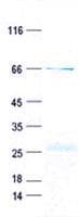 Human CD2 Protein (Recombinant GST, N-terminus + His, C-terminus)