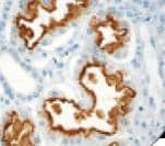 Monoclonal Mouse anti-Human Renal Cell Carcinoma Antibody (clone PN-15, Ready-to-Use, IHC)