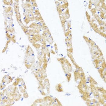 Polyclonal Rabbit anti-Human EGLN1 + EGLN2 Antibody (IHC)