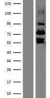 VIT Protein (Over-Expression Lysate Myc-DDK (Flag))