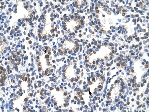 SNRPA / U1A Antibody (aa191-240, FITC)