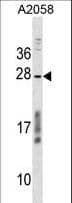 CCDC144NL Antibody (aa192-221)