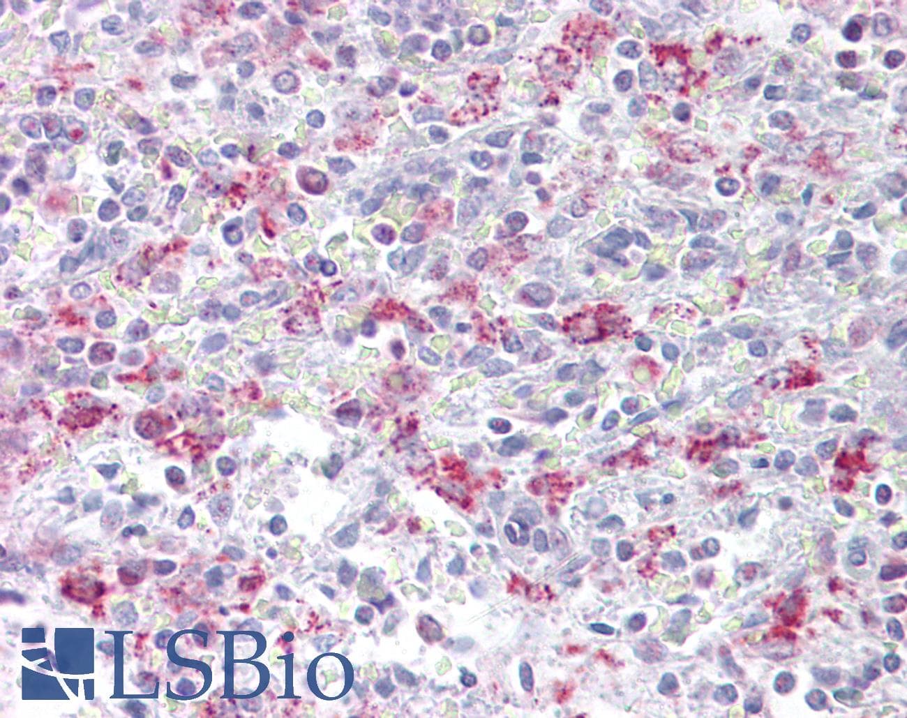 EZH1 / ENX-2 Antibody (N-Terminus)
