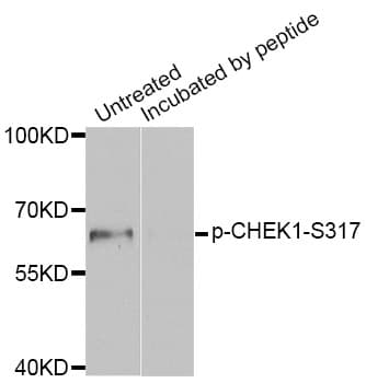 CHEK1 / CHK1 Antibody (phospho-Ser317)