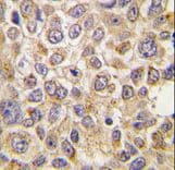 Polyclonal Rabbit anti-Human SLC29A4 Antibody (aa39-69, IHC, WB)