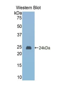CASP1 / Caspase 1 Antibody (aa120-297, FITC)
