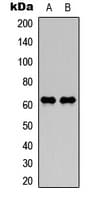 NF-L / NEFL Antibody (Internal)