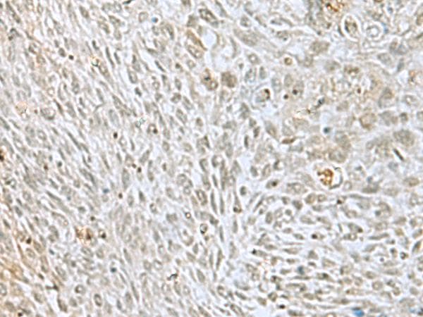 HOXC9 Antibody