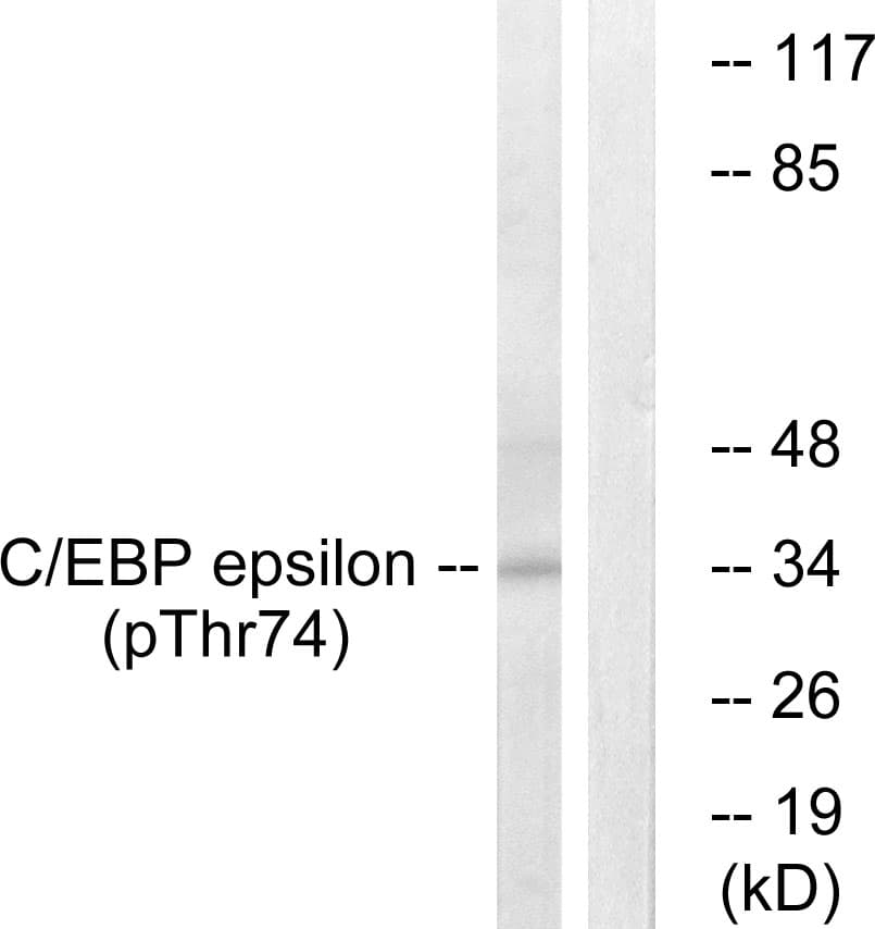 Polyclonal Rabbit anti-Human C/EBP Epsilon / CEBPE Antibody (phospho-Thr74, IHC, IF, WB)