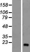 ZNF69 Protein (Over-Expression Lysate Myc-DDK (Flag))