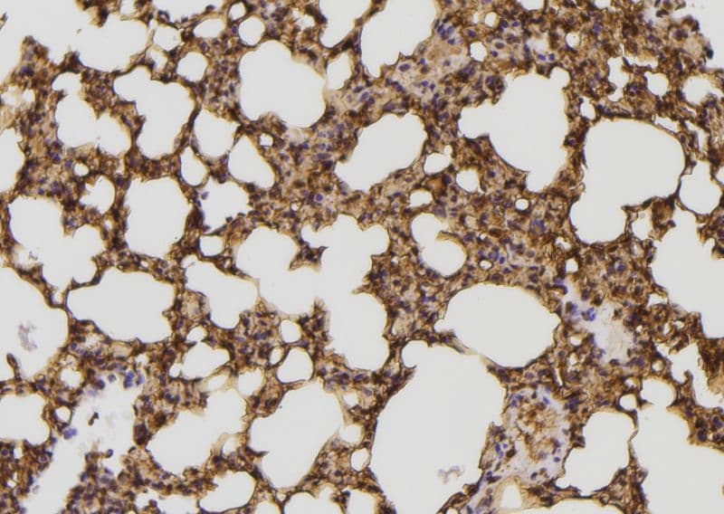 Polyclonal Rabbit anti-Human MAPK8IP2 / JIP2 Antibody (IHC, IF, WB)