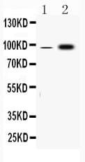 Polyclonal Rabbit anti-Human FGA / Fibrinogen Alpha Antibody (WB)