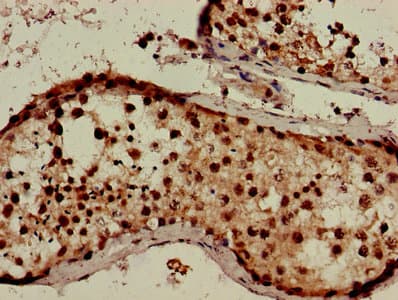 TMEM257 / CXorf1 Antibody