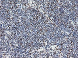 TLE1 / TLE 1 Antibody (aa180-460, clone OTI1F5)