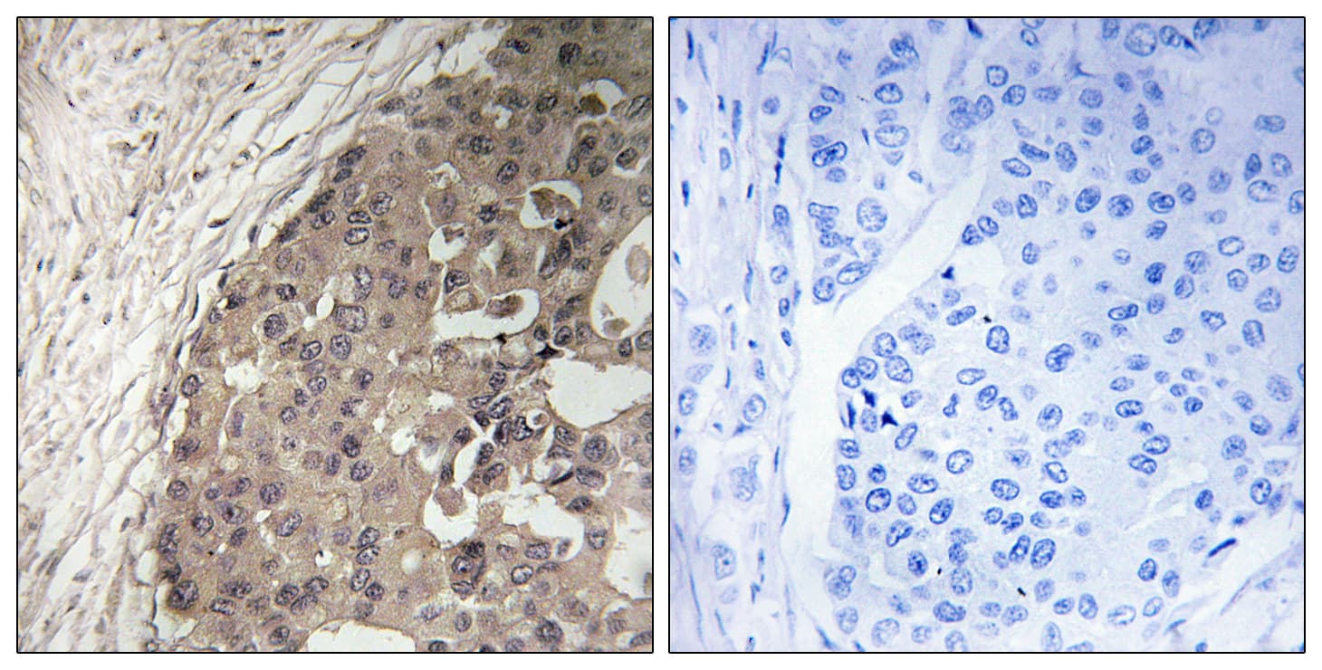 CSGALNACT1 Antibody (aa201-250)