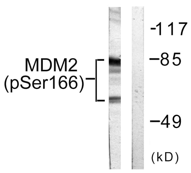 MDM2 Antibody (phospho-Ser166)