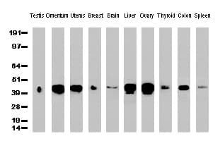 HP / Haptoglobin Antibody (clone UMAB10)