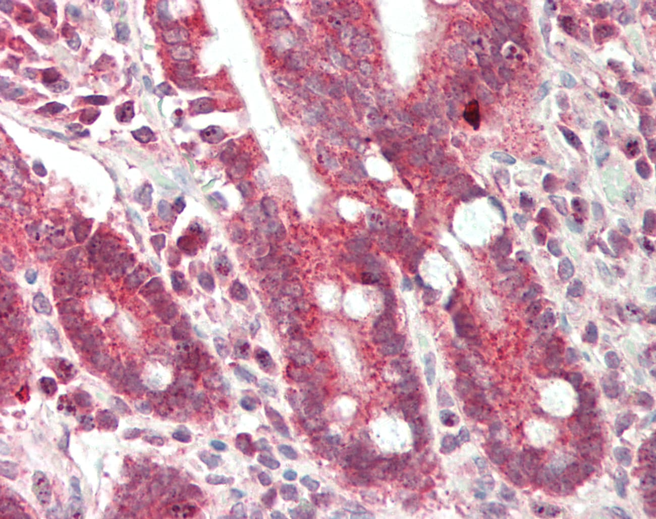 ADD3 Antibody (aa261-310)