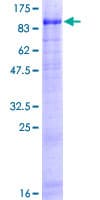 Human USP44 Protein (Recombinant GST)