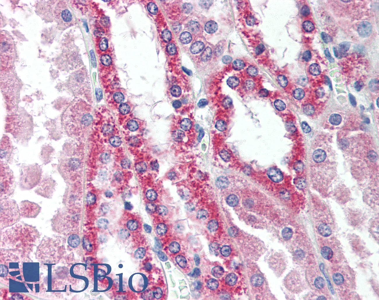 IHC-plus™ SIK2 / SNF1LK2 Antibody (aa100-150)