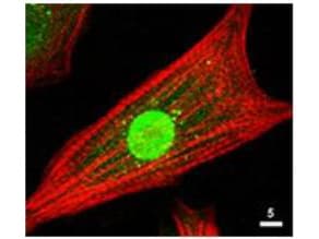 AKT1 + AKT2 + AKT3 Antibody (aa460-480)