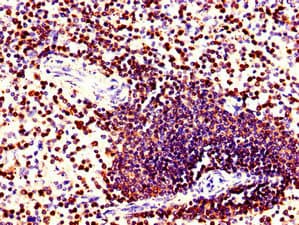 CORO1A / Coronin 1a Antibody