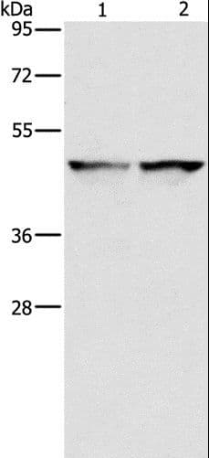 Polyclonal Rabbit anti-Human IDH1 / IDH Antibody (IHC, WB)