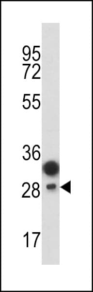 PROCR / EPCR Antibody (aa104-132)