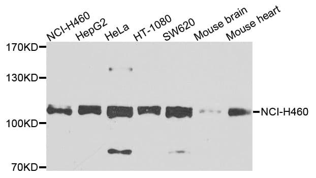 EPHB2 / EPH Receptor B2 Antibody