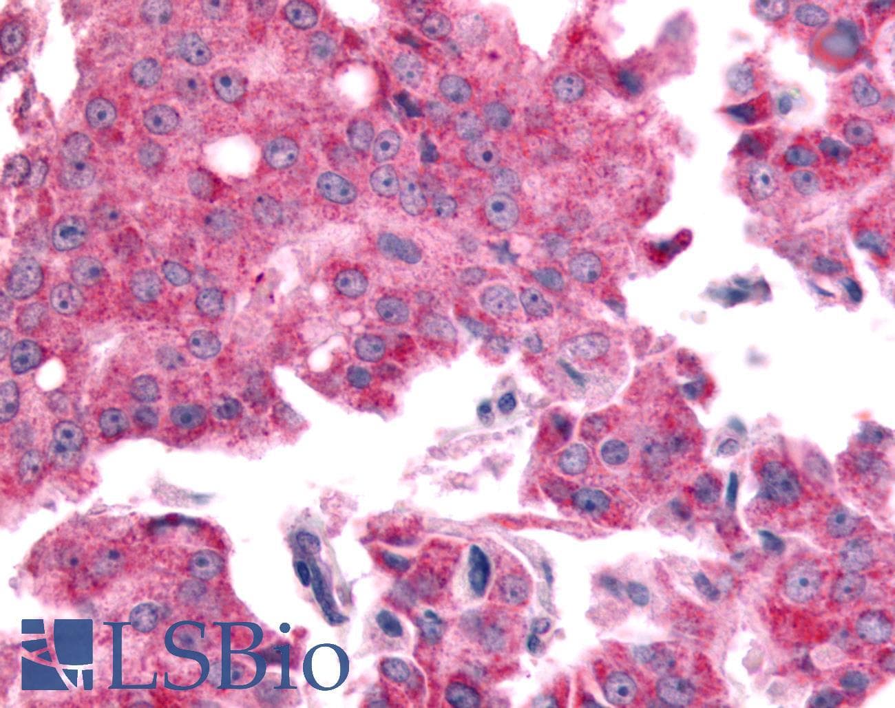 PathPlus™ SGK2 Antibody (Internal)