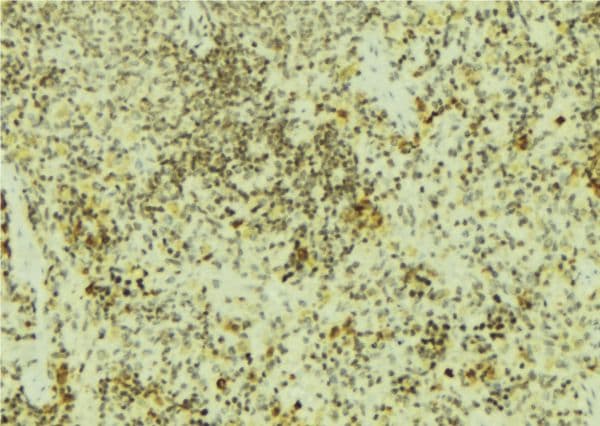 Polyclonal Rabbit anti-Human STUB1 / CHIP Antibody (IHC, IF, WB)