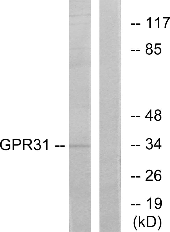 GPR31 Antibody (aa181-230)