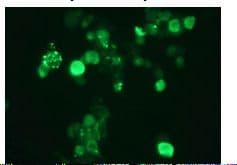 SUMO2 + SUMO3 Antibody (clone 1E7)
