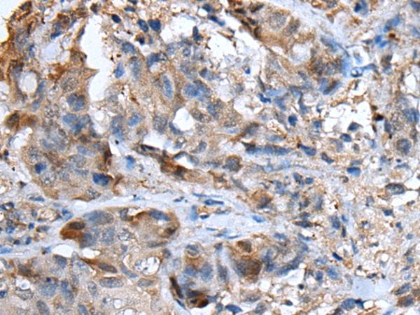 CXCL5 Antibody