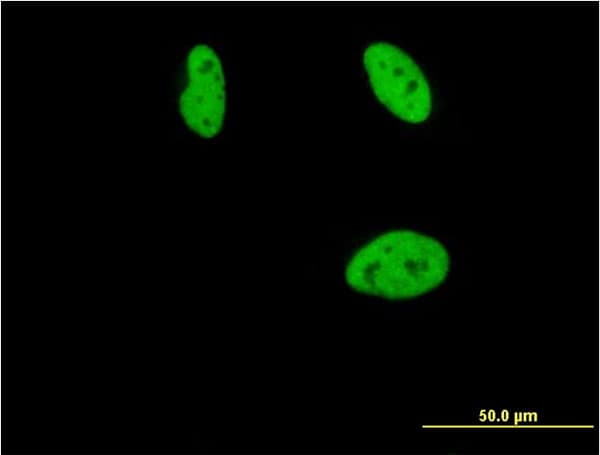PathPlus™ Monoclonal Mouse anti-Human CBFA1 / RUNX2 Antibody (clone 1D2, IHC, IF, WB)